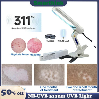 NB-UVB UV Phototherapy Light Instrument 311NM Narrowband Ultraviolet UVB Lamp Treatment for Anti Vitiligo