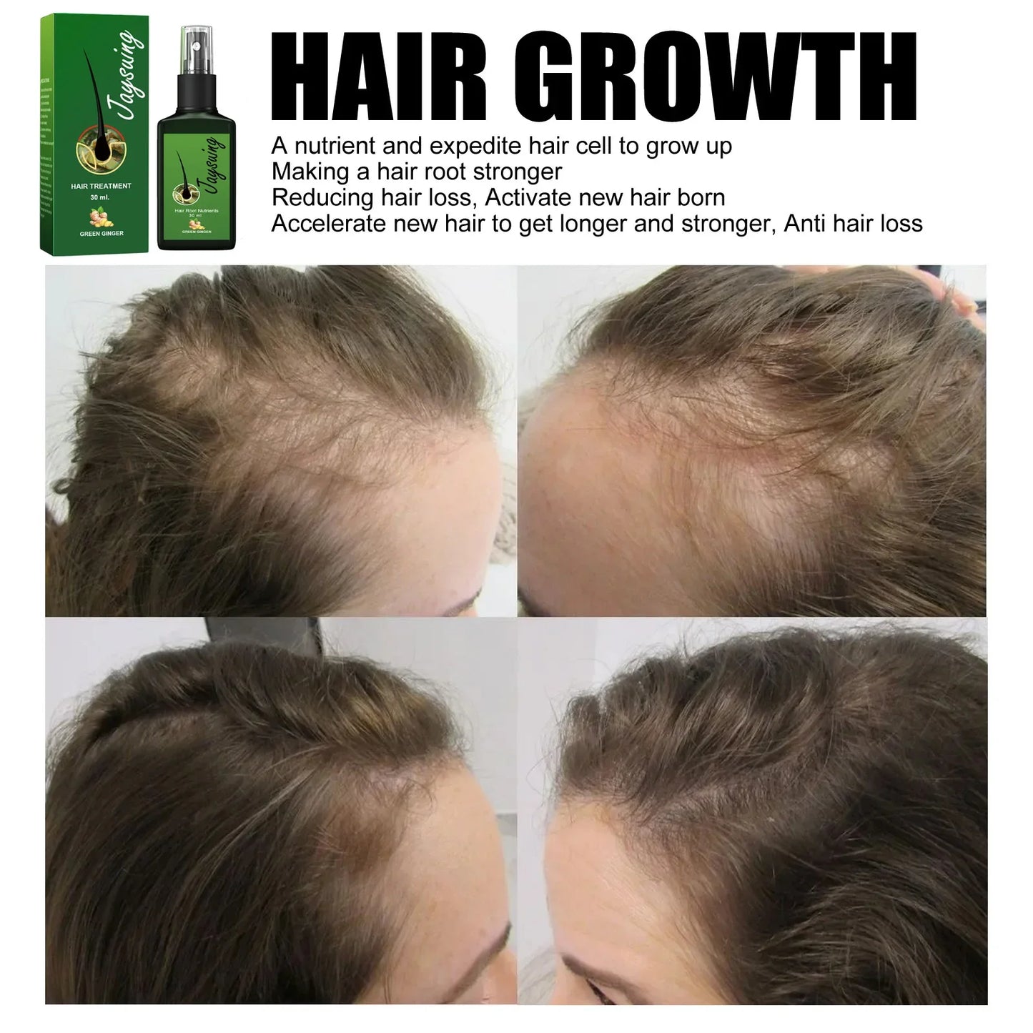 Serum Ginger Extract Anti Hair Loss Spray Products Treatment Hair Thinning Dry Fast Repair Prevent