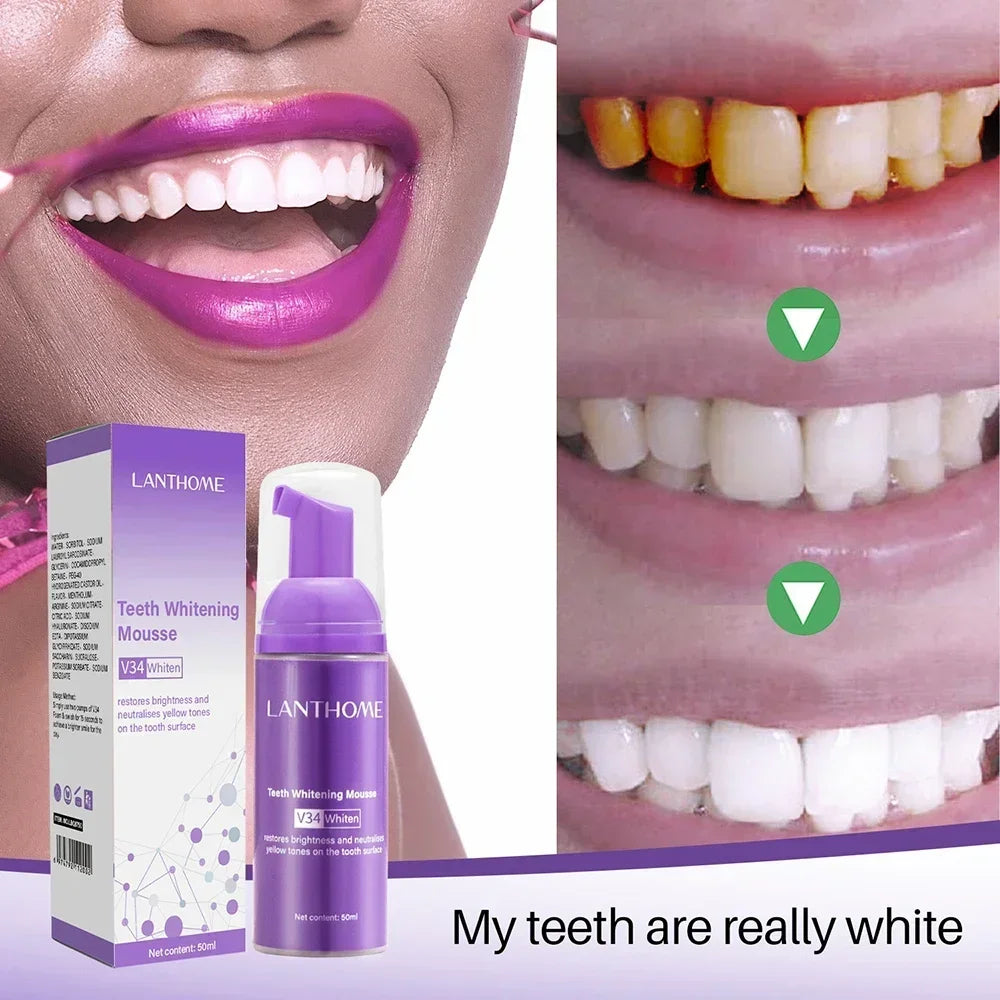 V34 Mousse Toothpaste Teeth Whitening Removing Yellow Teeth Cleaning Tooth Stain Oral Fresh Tooth Care Product Beauty Health ﻿