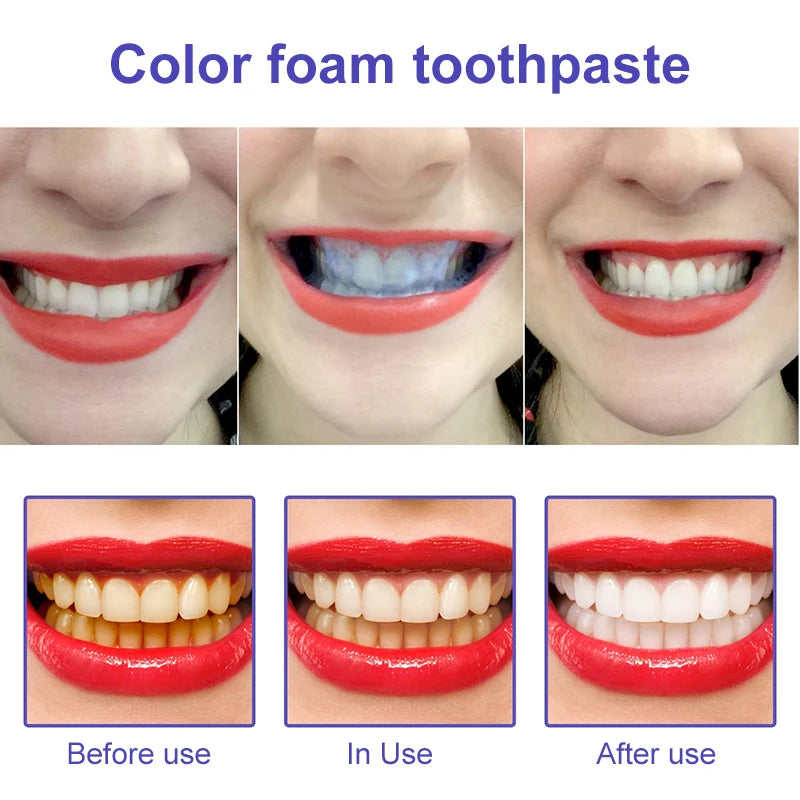 Probiotic Toothpaste Teeth Whitening Enzyme Remove Plaque Stains Oral Hygiene Cleaning Dental Tools Fresh Breath Beauty Health