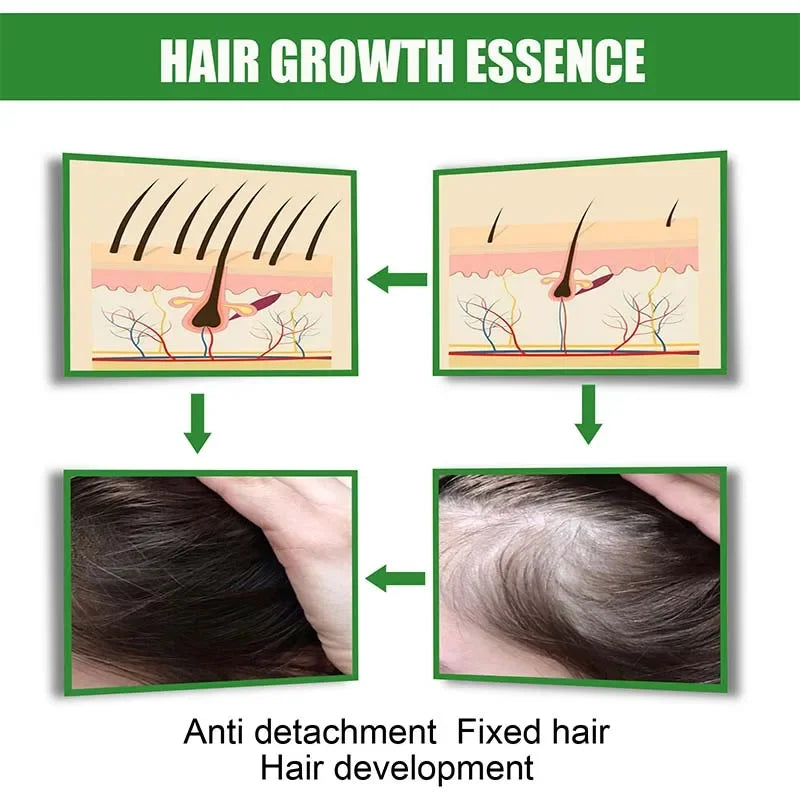 Serum Ginger Extract Anti Hair Loss Spray Products Treatment Hair Thinning Dry Fast Repair Prevent