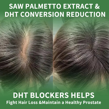 Saw Palmetto - Prostate Support, Prevents Hair Loss, Urinary Tract Health, Promotes Hair Growth