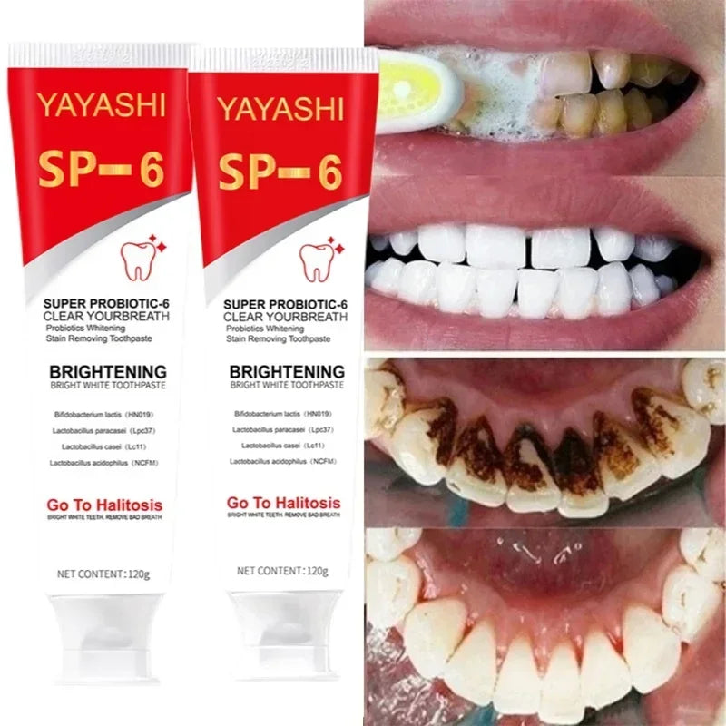 Probiotic Toothpaste Teeth Whitening Enzyme Remove Plaque Stains Oral Hygiene Cleaning Dental Tools Fresh Breath Beauty Health