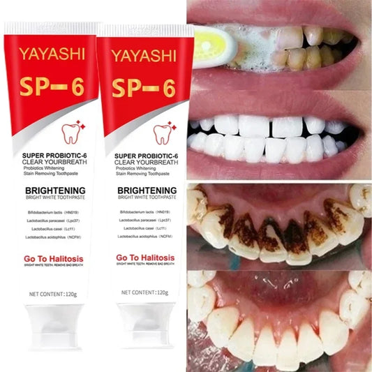 Probiotic Toothpaste Teeth Whitening Enzyme Remove Plaque Stains Oral Hygiene Cleaning Dental Tools Fresh Breath Beauty Health